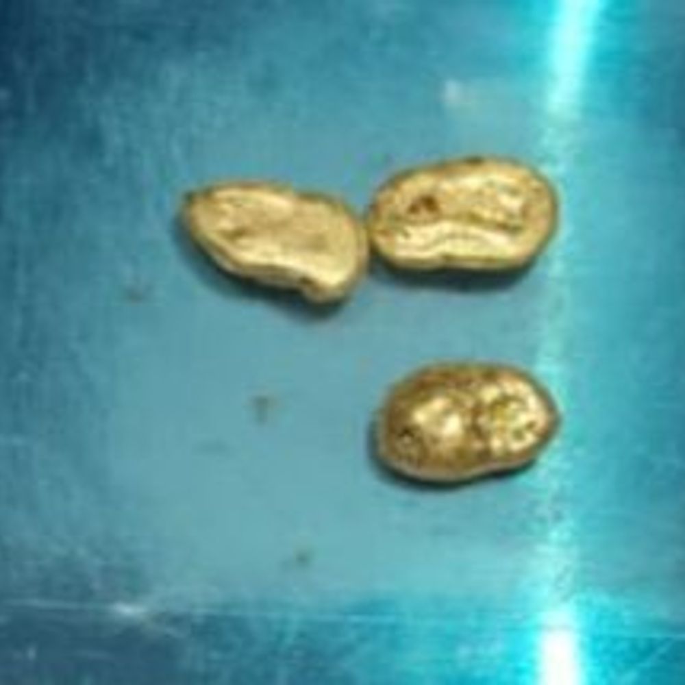 અમદાવાદ: અઠવાડિયામાં બીજા પેસેન્જરના શરીરમાંથી સોનું, અબુધાબીથી આવેલા પાસેથી 5 લાખનું GOLD જપ્ત.",