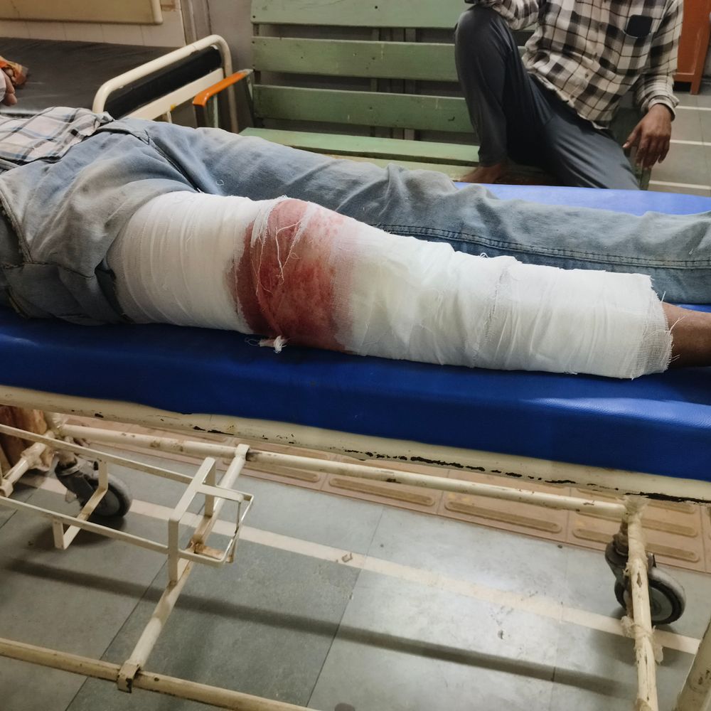 લુણાવાડા: બે બાઇક અથડામણમાં યુવક ગંભીર રીતે ઘાયલ, ગોધરા સિવિલ હોસ્પિટલમાં સારવાર હેઠળ.