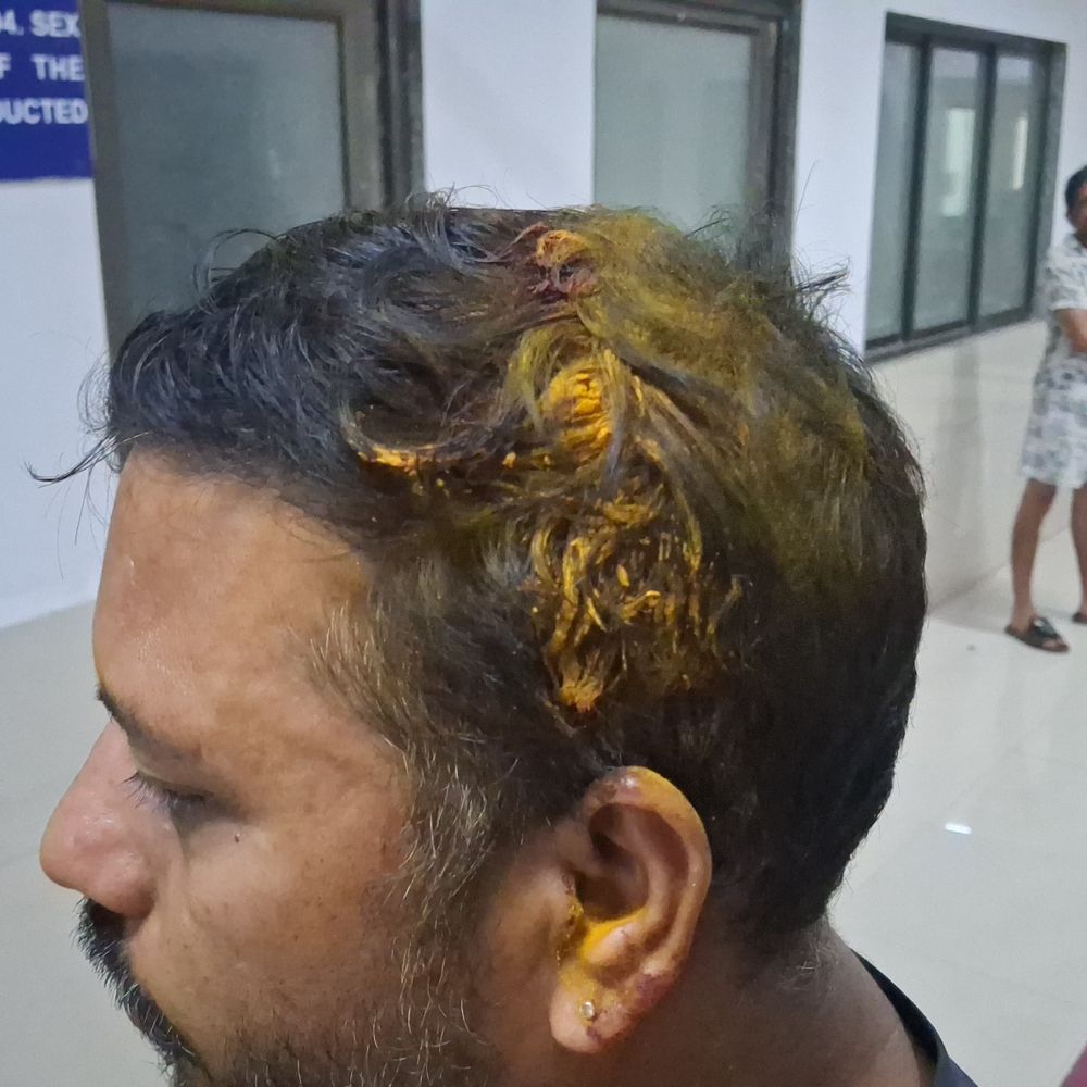 વલસાડના વેજલપોરમાં નજીવી બાબતે મારામારી