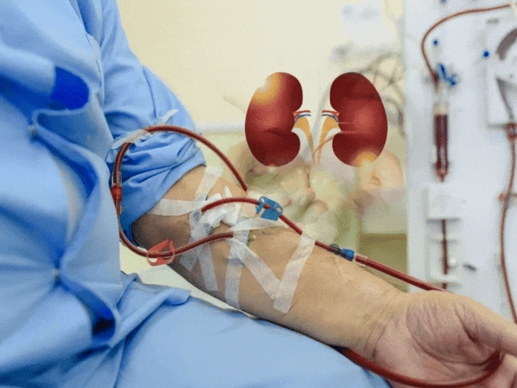 ગુજરાતમાં કિડની ટ્રાન્સપ્લાન્ટ માટે લાંબુ વેઇટિંગ લિસ્ટ, ડોનરની અછત, જીવનશૈલી સુધારી કિડની બચાવો ડોક્ટર્સની અપીલ.