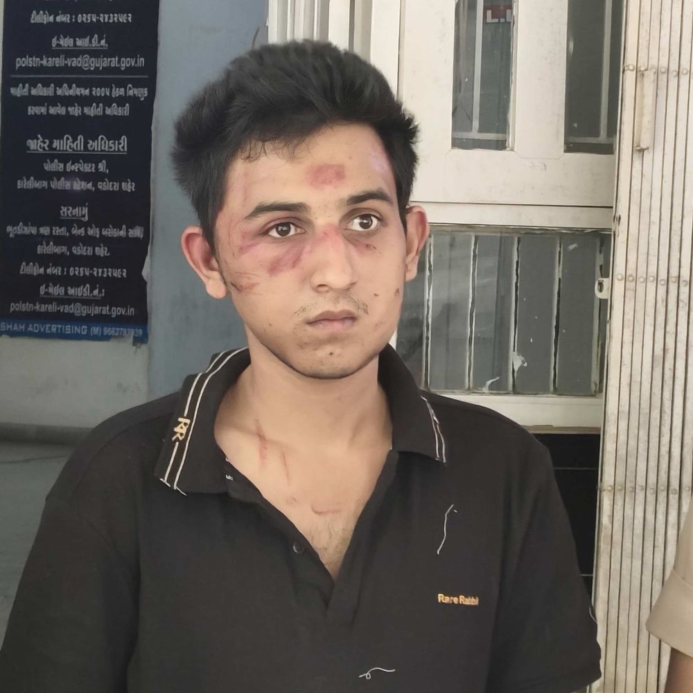 સુપ્રીમ કોર્ટે રક્ષિત ચૌરસિયાના જામીન રદ્દની રાજ્ય સરકારની અરજી ફગાવી:કારેલીબાગમાં નશામાં કાર ચલાવી 8 લોકોને અડફેટે લેતા એકનું મોત નીપજ્યું હતું