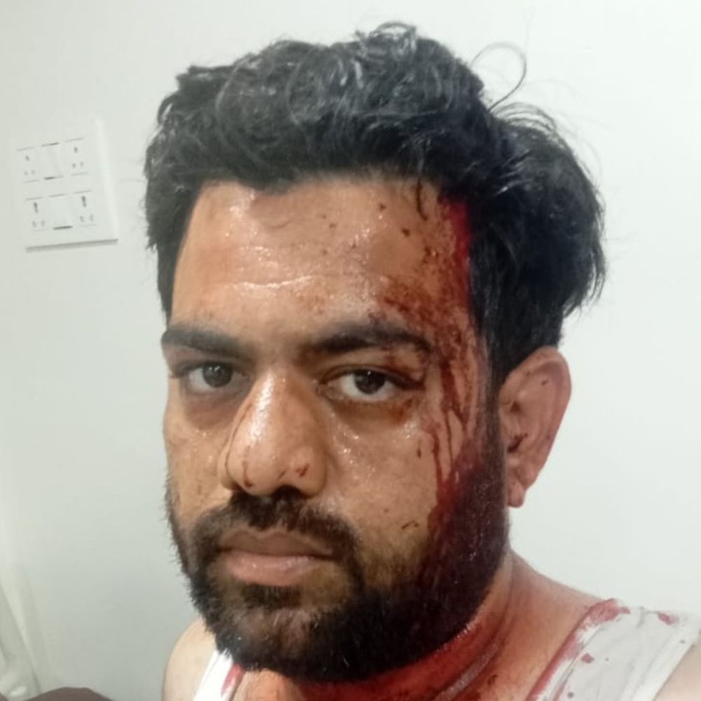 ચેટીચંડની રેલી બાદ સિંધી યુવકો પર પાઇપ-છરીથી હુમલો:યુવકને માથામાં 20થી વધુ ટાંકા આવ્યા, 15 દિવસમાં મારામારીની બીજી ઘટનાથી પોલીસની કામગીરી પર સવાલ