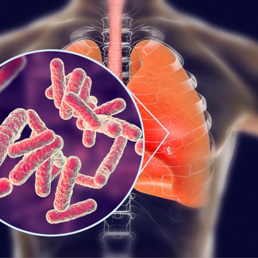 આજે વિશ્વ ટીબી દિવસ:પંચમહાલ જિલ્લામાં 2800 એક્ટિવ કેસ, એક વર્ષમાં 242ના મોત