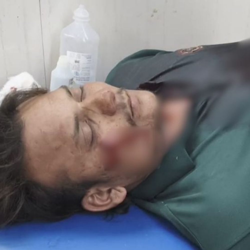 'હવે આ મામલામાં ન પડતો નહીંતર જાનથી મારી નાખીશું':મિત્રની પત્ની સાથેના આડા સંબંધની જાણ કરવાની આશંકામાં યુવક પર પાઈપથી હુમલો, ત્રણ આરોપીઓ વિરુદ્ધ ગુનો નોંધાયો