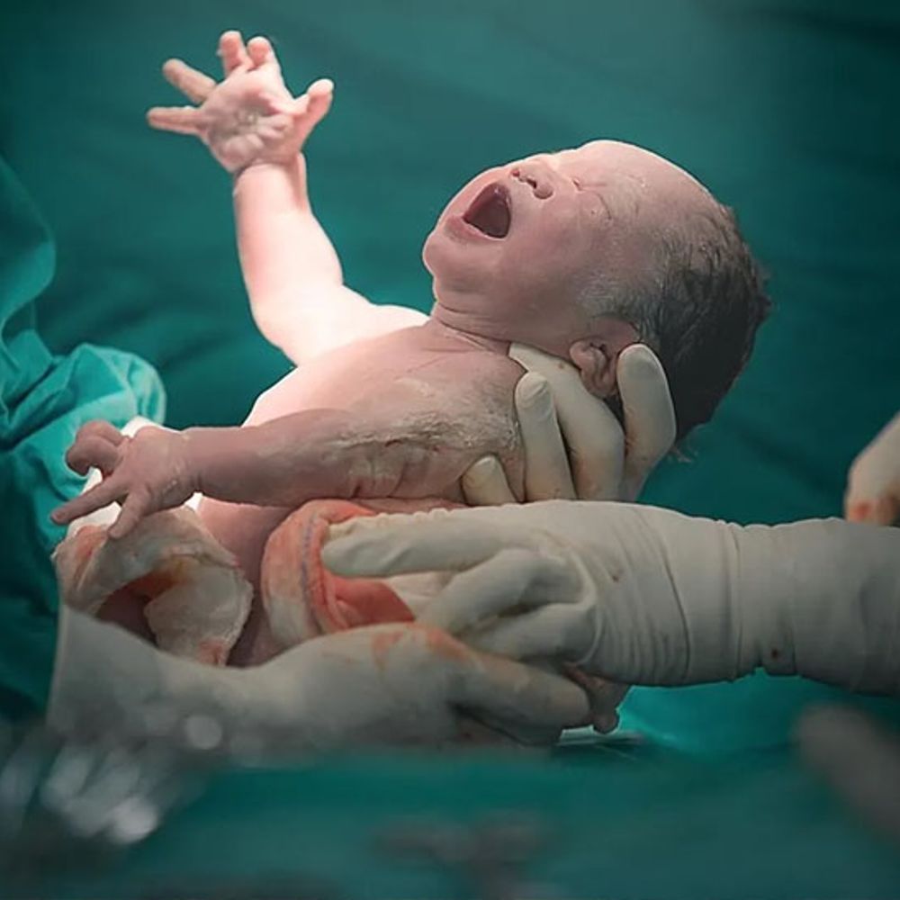 છેવાડાના વિસ્તારોમાં સુવિધા ક્યારે મળશે?:કચ્છમાં વર્ષ દરમિયાન 45,670 પ્રસુતિ થઈ, પીએચસીમાં માત્ર 880