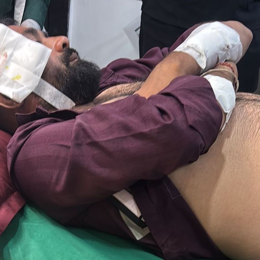 પુણાગામમાં ફિલ્મી દ્રશ્યો સર્જાયા:‘લાલો ક્યાં છે?’ કહી યુવક પર તીક્ષ્ણ હથિયારો અને પિસ્તોલ સાથે તૂટી પડ્યા, 9 સામે રાયોટિંગની ફરિયાદ દાખલ