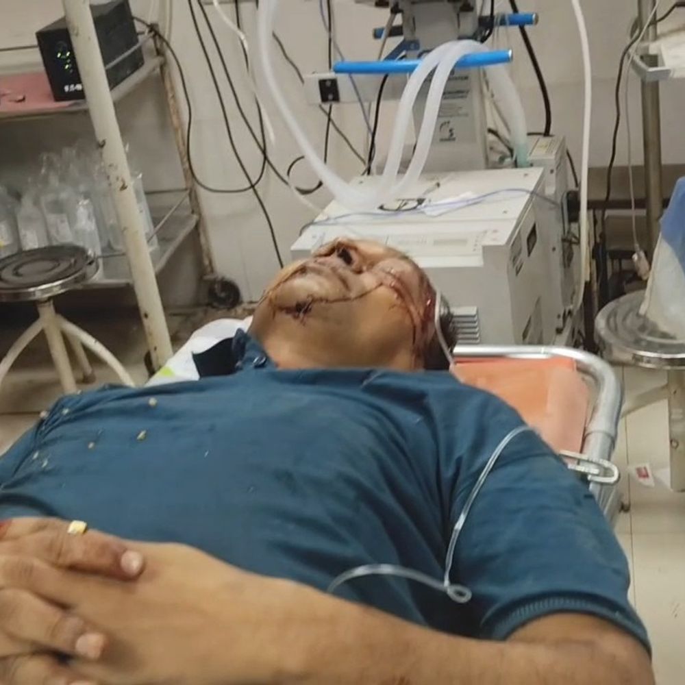 વલસાડ સ્ટેશને ચાલુ ટ્રેનમાંથી પટકાયા મુસાફર:ચા લેવા ઉતર્યા બાદ ચઢતી વખતે અકસ્માત, સુરત રિફર કરાયા