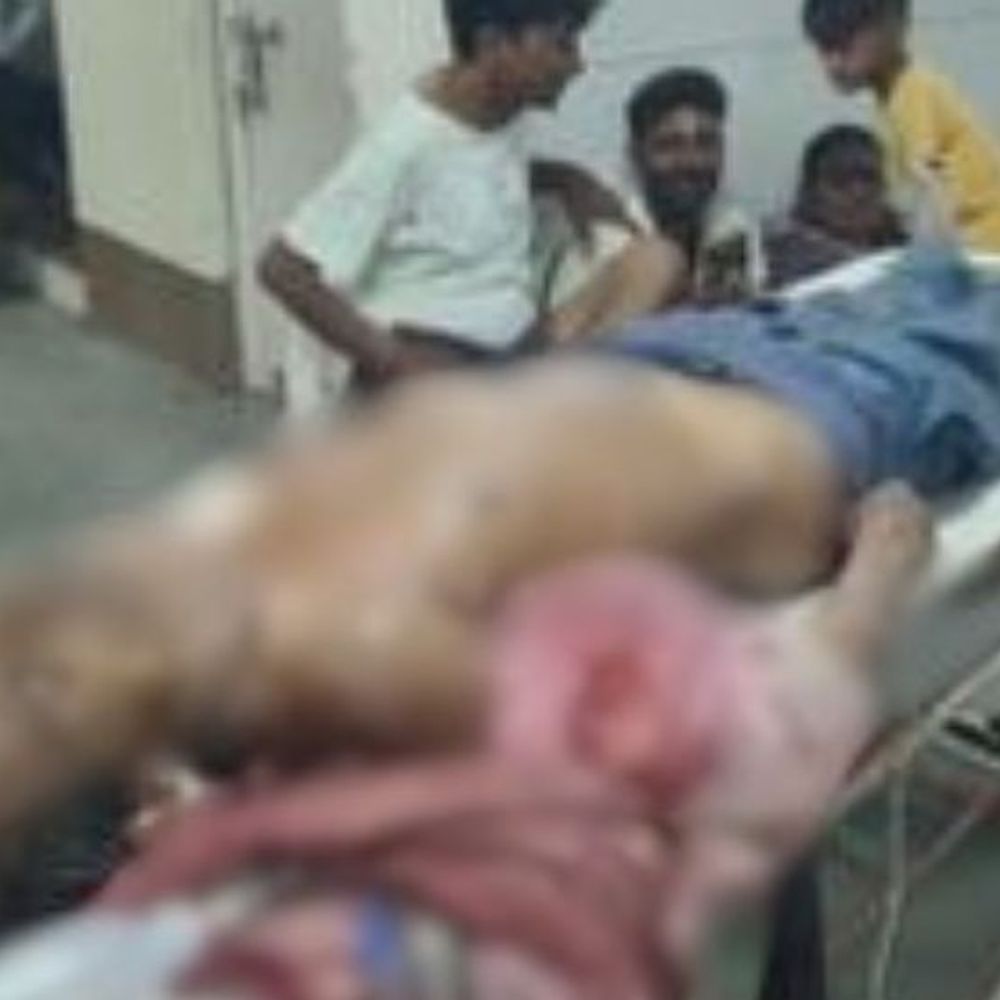 સરદાર એસ્ટેટમાં જૂની ઝઘડાની અદાવતમાં ખંજરથી હુમલો:યુવકને પેટ અને છાતીના ભાગે ખંજર ઝિંકનાર આરોપી સહિત 4 લોકોને પોલીસે ઝડપી પાડ્યા