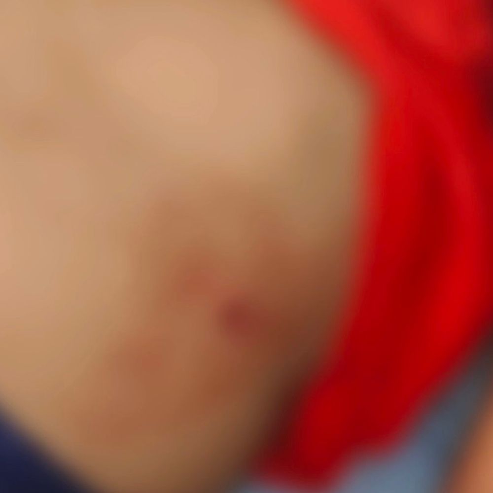 ગોધરામાં યુવાન પર ચપ્પુથી હુમલો:ઝાકીર હુસૈન સ્કૂલ પાસે ઘટના, આરોપી ફરાર