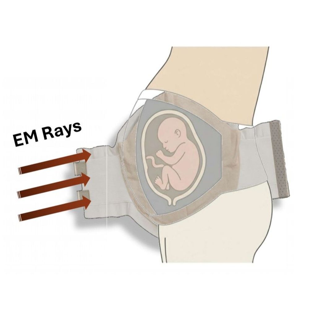MSUના વિદ્યાર્થીએ રેડિયેશનથી સગર્ભાને બચાવવા સ્ટેનલેસ સ્ટીલનો મેટરનિટી બેલ્ટ બનાવ્યો.