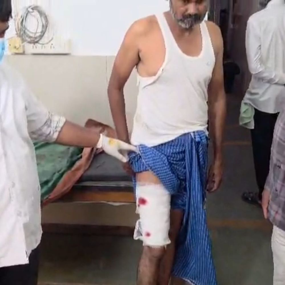 કૃષ્ણગઢમાં યુવાન પર સિંહનો હુમલો: સાથળ ફાડી ખાધો, મોટી દુર્ઘટના ટળી.