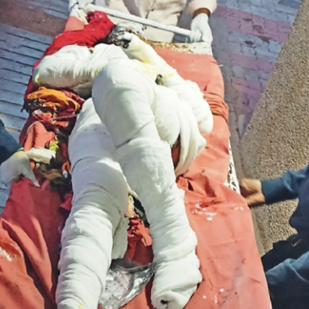 કાણોદરની કંપનીમાં ઓઈલ ટાંકીમાં સળિયો પડતા ભયંકર આગ, 10થી વધુ મજૂરો દાઝ્યા.