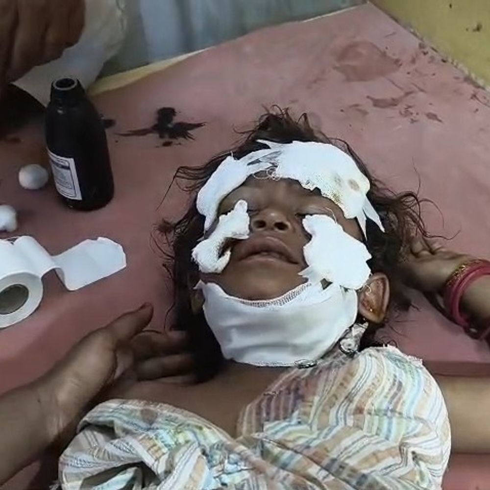 પાવીજેતપુરમાં દીપડાના જડબામાંથી પિતાએ દીકરીને છોડાવી:નાની રાસલીમાં રાત્રે ઘરમાં રમતી 4 વર્ષની ઘ્રૂવીષાને દીપડે ગળેથી દબોચી, માસૂમ બોડેલીની હોસ્પિટલમાં