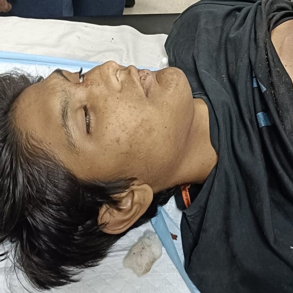 અમદાવાદમાં ઇન્સ્ટા પર સ્ટોરી મૂકવા બાબતે યુવકની હત્યા:આયશા મસ્જિદ પાસે 3 આરોપીએ બે મિત્રો પર છરી-પથ્થરથી હુમલો કર્યો, 24 કલાકમાં બીજું મર્ડર