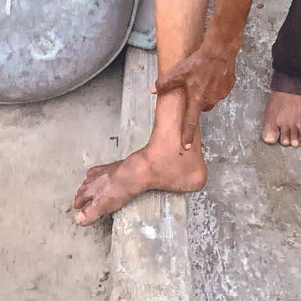 શ્વાનની આતંક:ઓડમાં રખડતા શ્વાને પાંચ લોકોને બચકાં ભરતા ફફડાટ