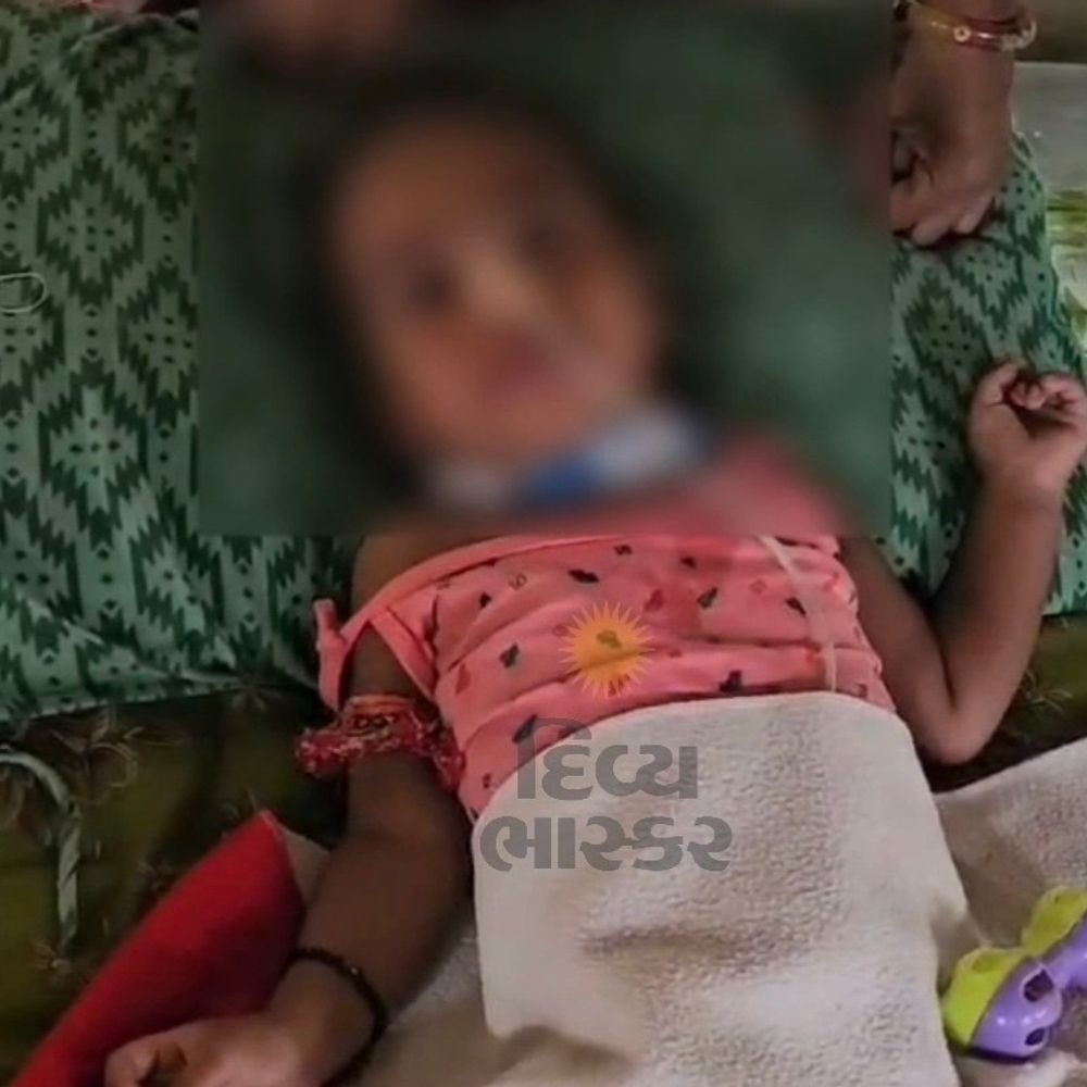 પંચમહાલમાં GBSના 3 શંકાસ્પદ કેસ નોંધાયા:ગોધરા, મોરવા હડફમાં સર્વેલન્સ, 400થી વધુ બાળકોની તપાસ