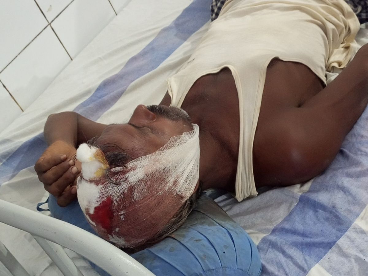 घर घुसकर लाठी-डंडे से कर दी धुनाई, अस्पताल में भर्ती हैं तीनों | Dabangs  brutally beat up 3 people in Jamui - Dainik Bhaskar