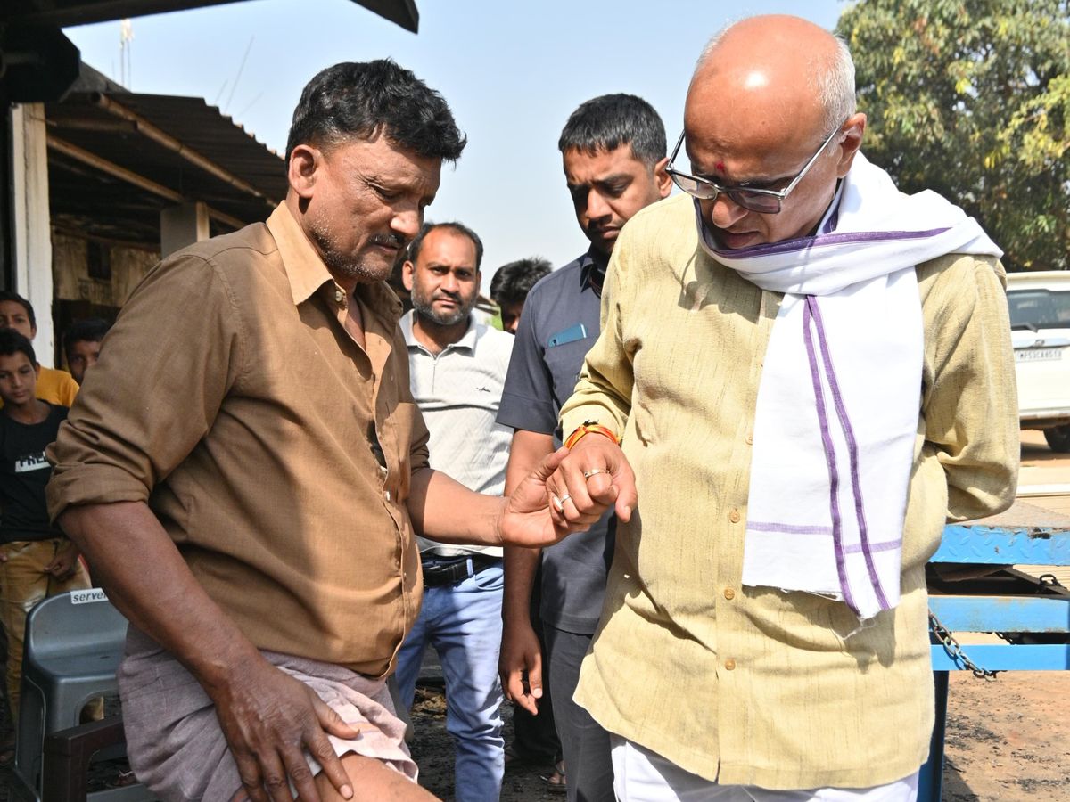 Sidhi Fire Accident | MP Rajesh Mishra Visits Victims, Offers Aid