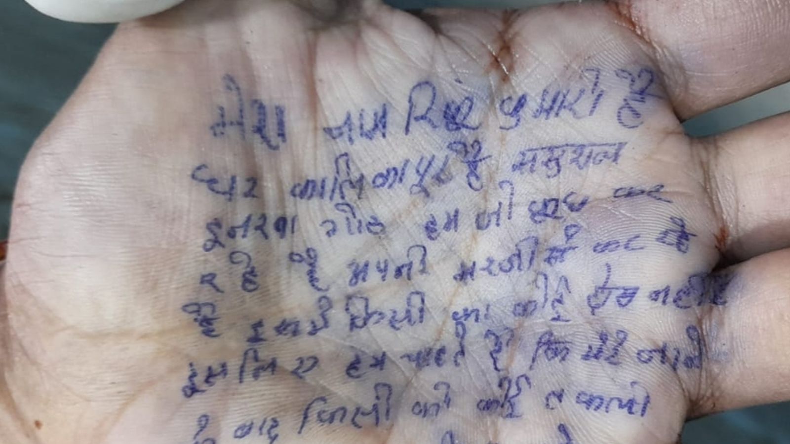हाथ को बनाया सुसाइड नोट, लिखा-मेरे जाने के बाद किसी को कोई तकलीफ नहीं होनी  चाहिए | Bihar: Hand made suicide note, wrote - no one should have any  problem after my