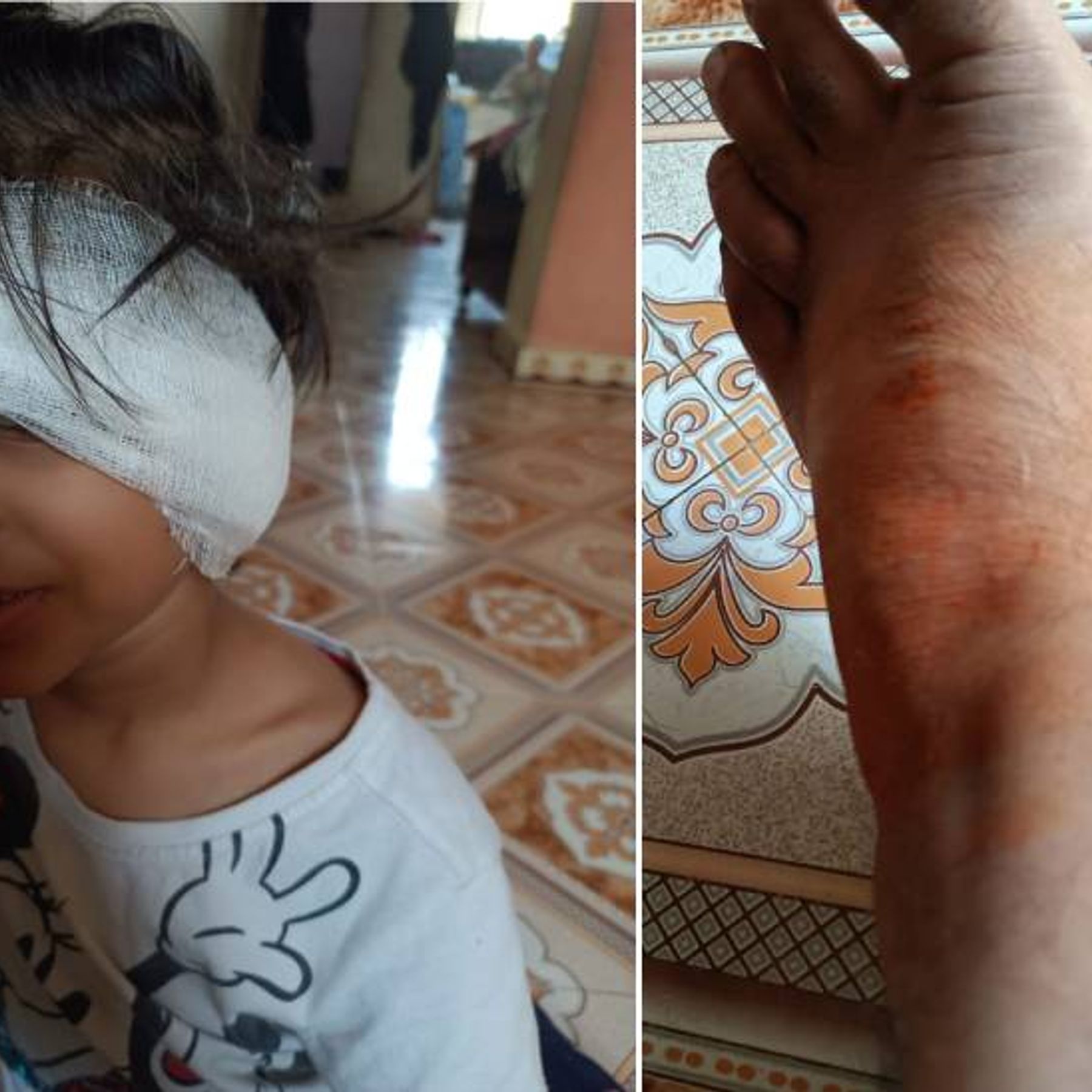 In Ahmedabad, a stray cow on a bike hit a father and daughter, leaving the  father with a fractured leg and the daughter with stitches in the head. | અમદાવાદમાં  રસ્તે રખડતી