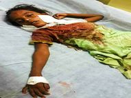 जावर माइंस में 5 साल की बच्ची पर तेंदुए ने किया हमला, मुंह में दबा ले जाने लगा जंगल, तभी माता-पिता ने तेंदुए से लड़ बचाई बेटी की जान|उदयपुर,Udaipur - Dainik Bhaskar