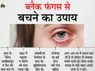 प्रदेश में 50% केस सिर्फ जयपुर में, अब तक 1054 संक्रमित, इनमें 44 लोगों ने दम तोड़ा, 535 केसों में हुई सर्जरी|जयपुर,Jaipur - Dainik Bhaskar