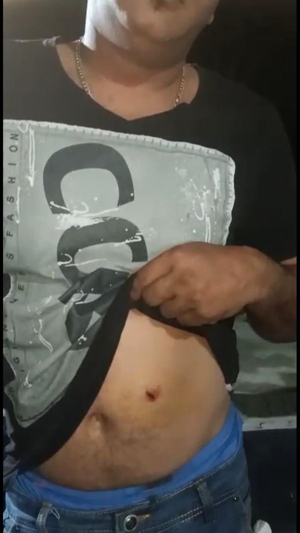 पहले मारी कैंची की चोट दिखाता अमित।