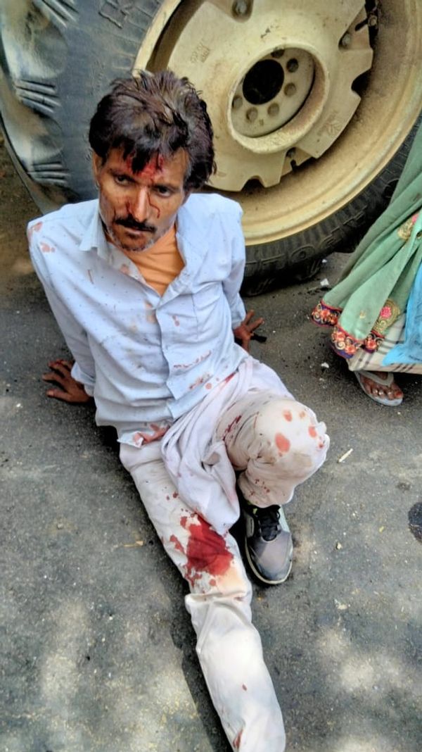 हादसे में घायल कार ड्राइवर