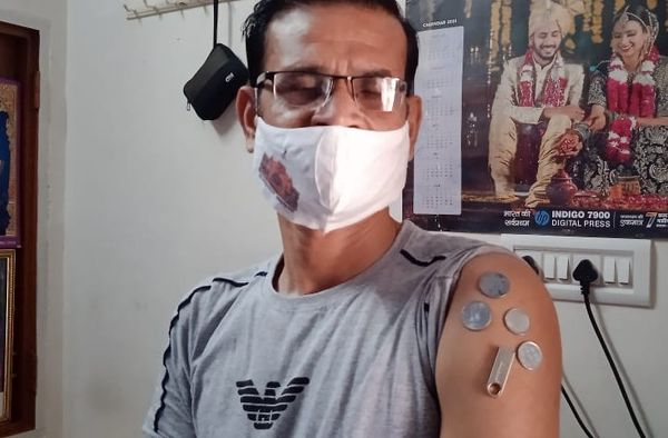 बायां हाथ लोहे के सम्पर्क में आने से चमड़ी खिंचने की शिकायत होती थी।