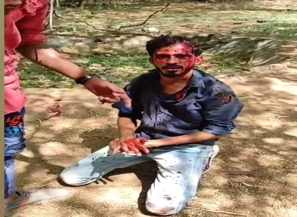 खून से लथपथ प्रकाश मारपीट नहीं करने की विनती करते हुए।