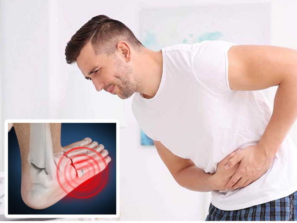 Kidney stones increase the risk of fractures in bones, these 5 symptoms indicate stones. | किडनी में पथरी होने पर हडि्डयों में फ्रेक्चर होने का खतरा, पेट में निचले हिस्से में दर्द और उल्टी पथरी होने का इशारा; जानिए किडनी कैसे स्वस्थ रखें