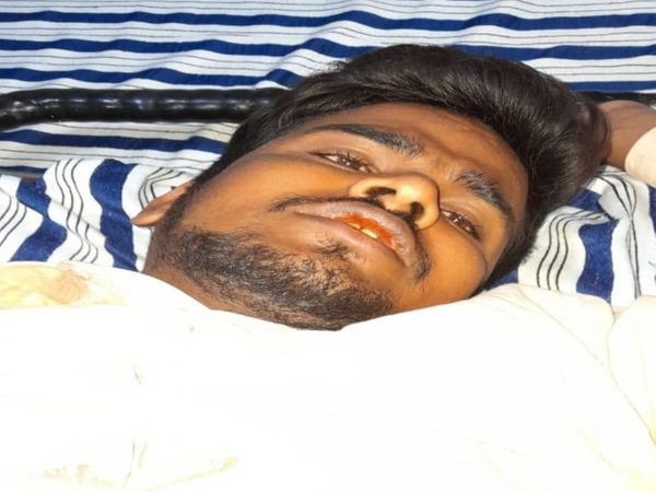 बदमाश ने सीने पर फायर करना चाहा रोहित ने हाथ पकड़ लिया जिसकी वजह से जांघ में गोली लगी। - Dainik Bhaskar
