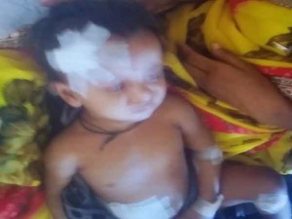 मासूम के पेट और चेहरे पर गंभीर घाव थे।