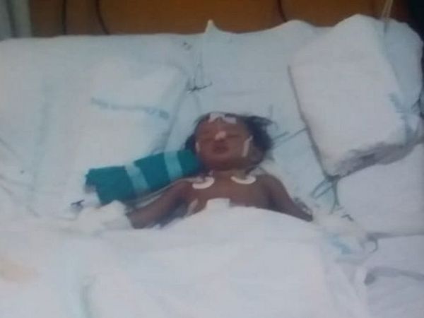 अस्पताल में 9 दिनों तक मासूम जिंदगी की जंग लड़ती रही।