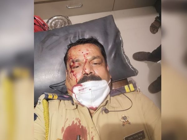 हमले में घायल पुलिसकर्मी को अस्पताल ले जाते हुए। चारों घायल पुलिसकर्मी अस्पताल में भर्ती हैं। इनमें से एक की हालत गंभीर है।