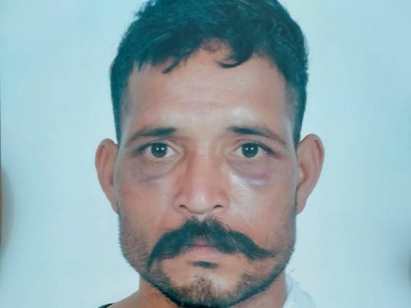 युवक के चेहरे पर भी निशान दिख रहे हैं।