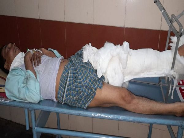 अलमास का एमवाय अस्पताल में इलाज चल रहा है।