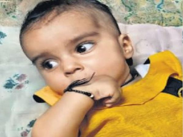 A 7-month-old girl gets a spinal muscular atrophy, an injection of Rs 16 crore to save her life. | 7 माह की बच्ची को स्पाइनल मस्कुलर एट्रोफी नाम की रेअर बीमारी, जान बचाने के लिए 16 करोड़ रुपए का लगेगा इंजेक्शन 2 स्पाइनल मस्कुलर एट्रोफी से पीड़ित नूर फातिमा। - Dainik Bhaskar