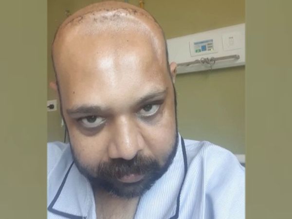 दवाओं का कोर्स पूरा होने के बाद ही उनकी न्यूरो सर्जरी की जाएगी।