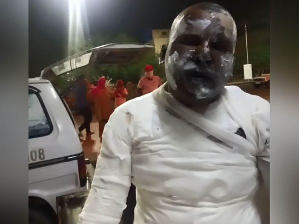 बहादुरगढ़ के नजदीकी गांव कसार में आग लगाए जाने के बाद गंभीर रूप से घायल गांव का मुकेश। - Dainik Bhaskar