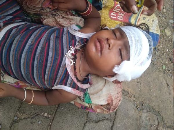 घायल बच्ची मीनाक्षी को अब होश आ गया है। मां से मिलने के बाद बच्ची गले से लिपट गई।