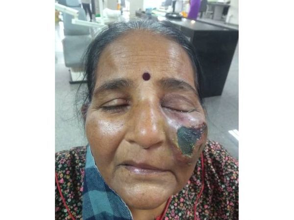 ઓક્સિજનનું પ્રમાણ અને ક્વોલિટી પણ જરૂરી ભાગ ભજવે છે