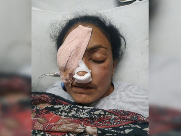 મ્યુકોરમાઇકોસિસના દર્દીની ફાઈલ તસવીર