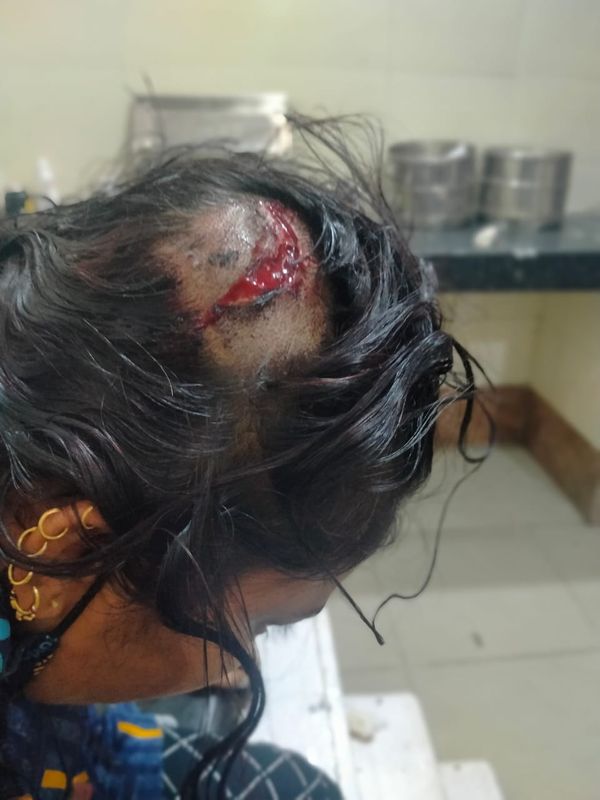 दीपा गुर्जर के सिर में लगी चोट