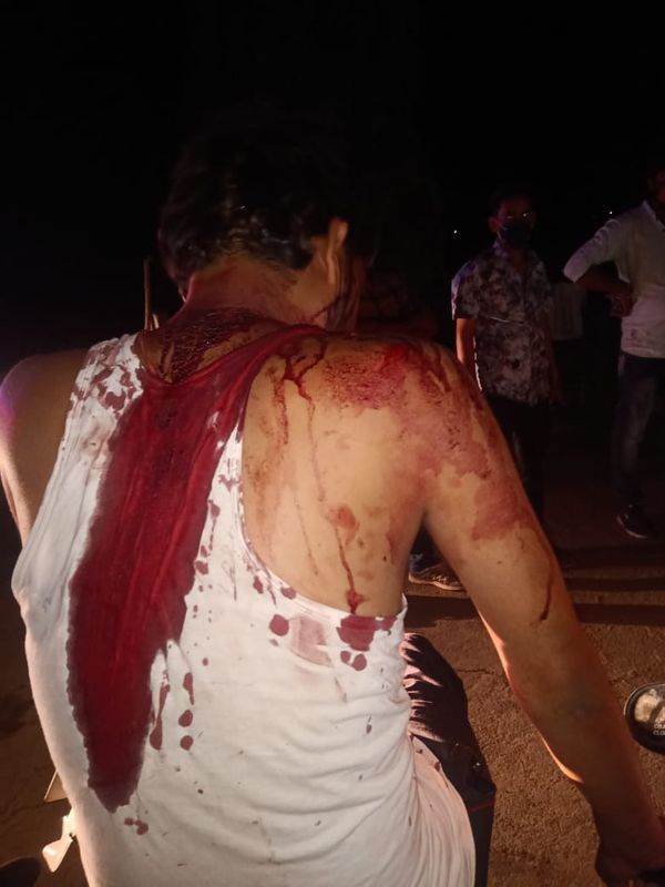 डकैतों के हमले में घायल होने के बाद खून से लथपथ शिवराज रघुवंशी।