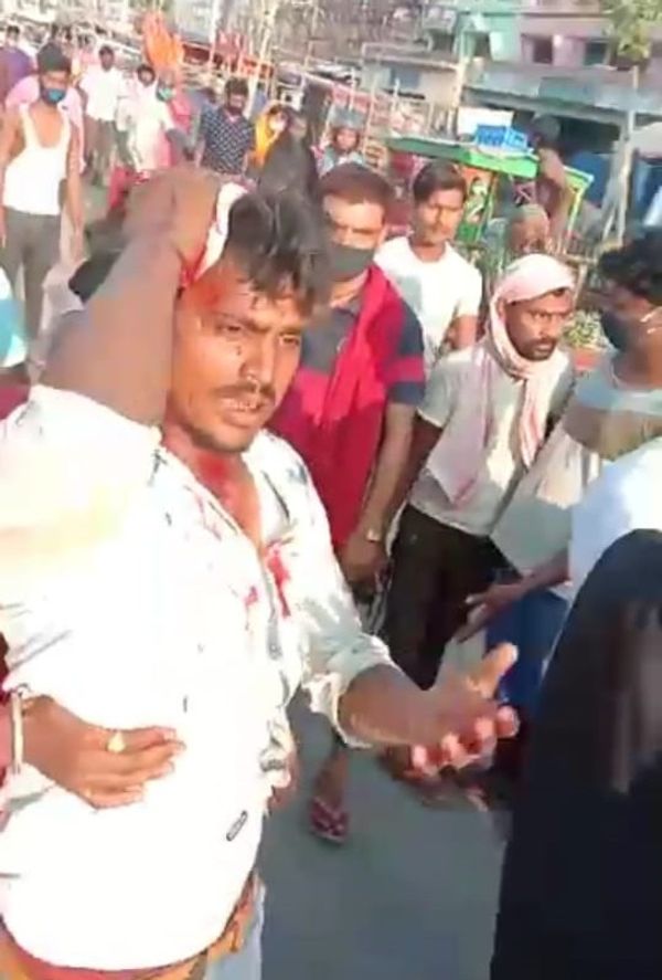 घायल फल दुकानदार।