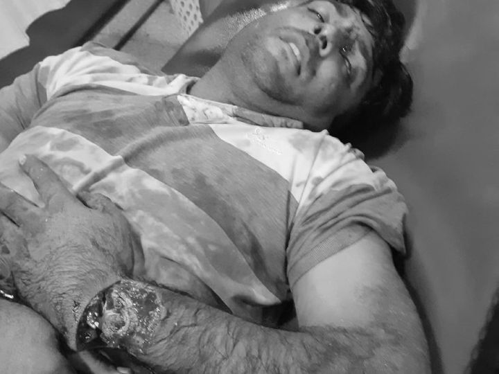 भाजपा उपाध्यक्ष के घर आधी रात हमला:आधा दर्जन गाड़ियों में भरकर आए दो दर्जन हमलावर