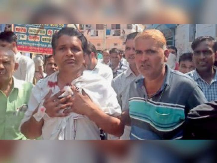 बहन को प्रवेश पत्र दिलाने आए युवक ने की फायरिंग, राहगीर समेत 2 घायल