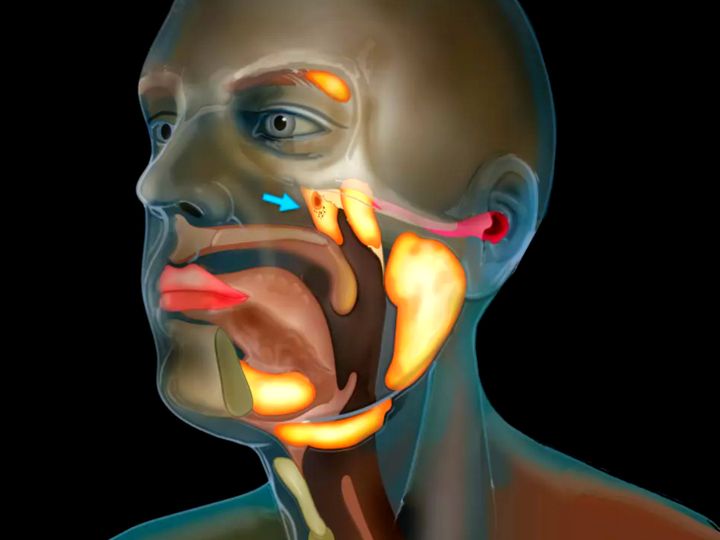 नीदरलैंड्स के वैज्ञानिकों की खोज:वैज्ञानिकों ने इंसान में नया अंग खोजा, कहा; नाक के पिछले हिस्से में मिला यह अंग कैंसर के इलाज में मदद कर सकता है