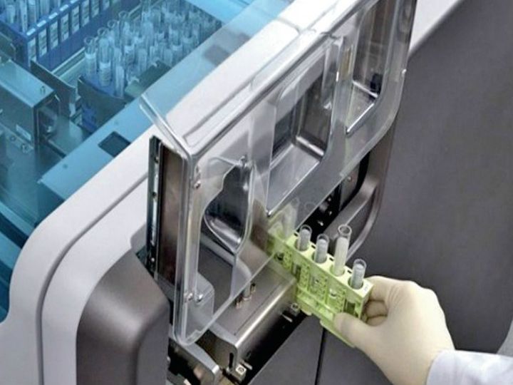 orig corona test 22 1605225404